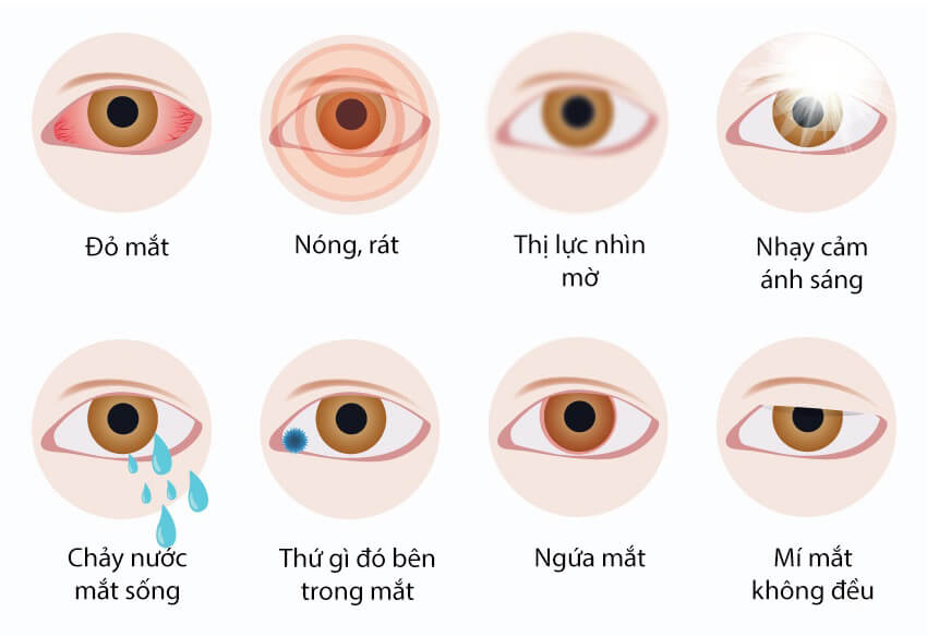 Dấu hiệu cần khám mắt ngay – Đừng chủ quan với thị lực